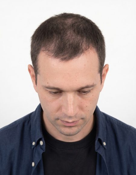 Male-hair-6-to-12-months.jpg