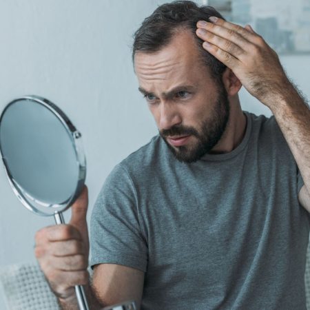 What-Is-Male-Pattern-Hair-Loss.jpg